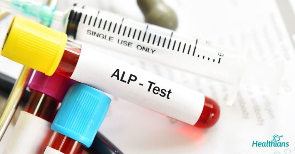 Alkaline Phosphatase Test, Importance of ALP Test