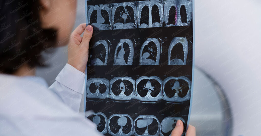 Diagnostic Imaging: X-rays, CT Scans, and MRI explained - HEALTHIANS BLOG